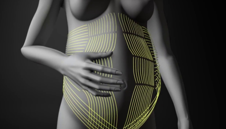 Diastasis Recti: Why The Dia Method Works? | Pregnancy Video
