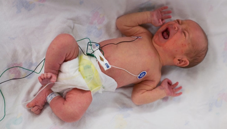 How to Reduce Reflux in Babies?