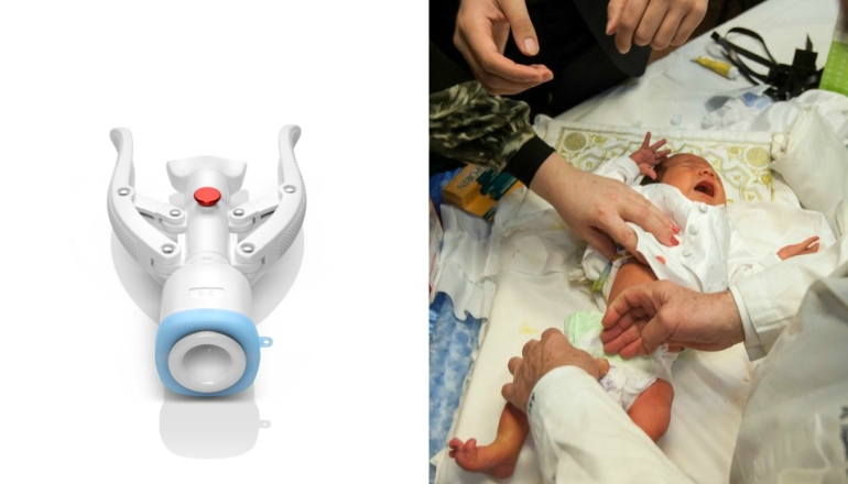 The Myths and Facts of Baby Circumcision