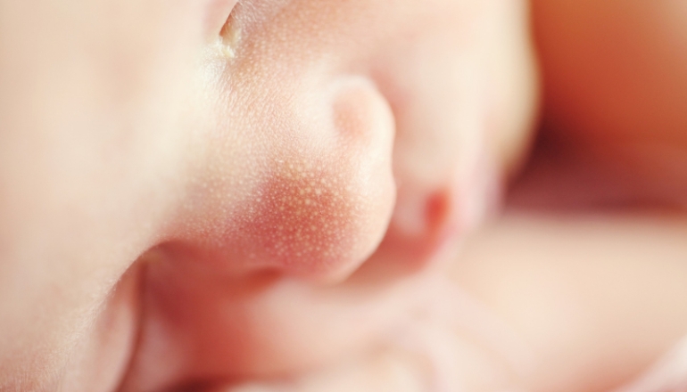 Your Baby's Skin: What Makes it Unique
