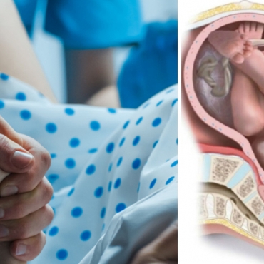 3 Major Ways to Prevent Vaginal Tearing During Birth