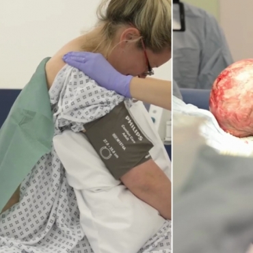 Anaesthetic Procedure for Elective Caesarean Section