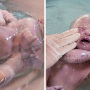 Baby Born in Amniotic Sac: Mateja’s Birth