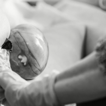 Baby Was Born in the Caul After a Powerful Labor