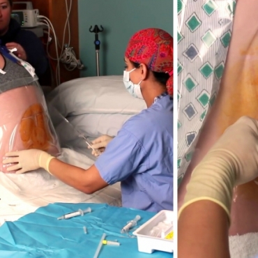 Birth Guide: Epidural Anaesthesia for Pregnant Women