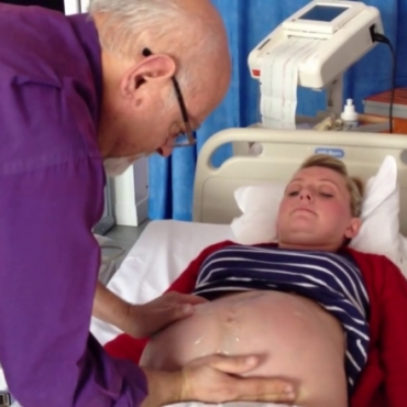 Breech Baby: Successful External Cephalic Version