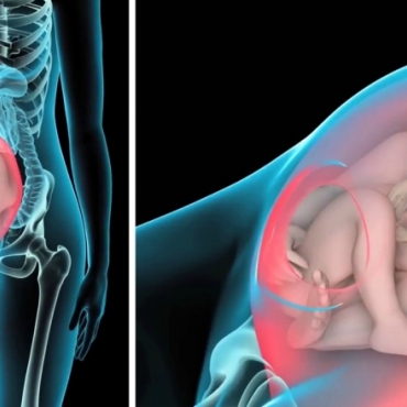 Delivery Complications During Cesarean Section