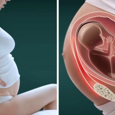 Every Pregnant Woman Should Know About Round Ligament Pain