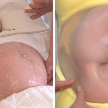 External Cephalic Version (ECV) for Breech Position