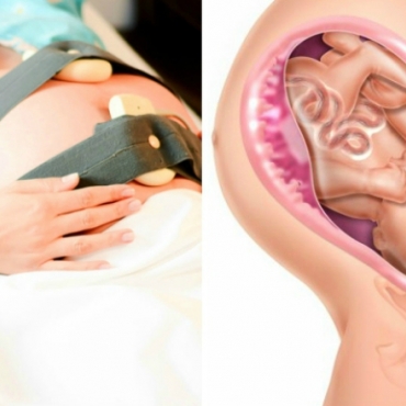 First Stage of Labour: What You Can Expect to Happen?