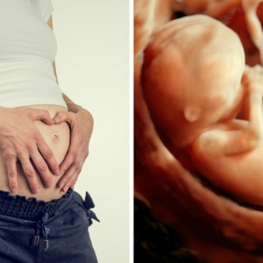 How to Predict Your Baby Gender at 13 Weeks