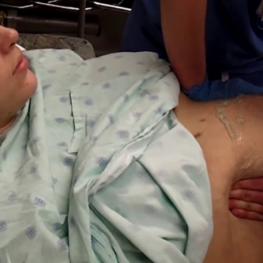 How to Turn a Breech Baby? (External Cephalic Version)