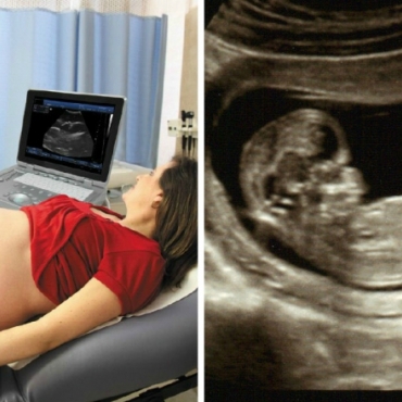 Is it a Boy or Girl: 8 Common Gender Prediction Methods