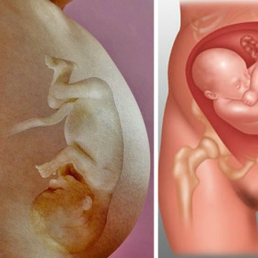 Last Month of Pregnancy: Baby Positions in the Womb