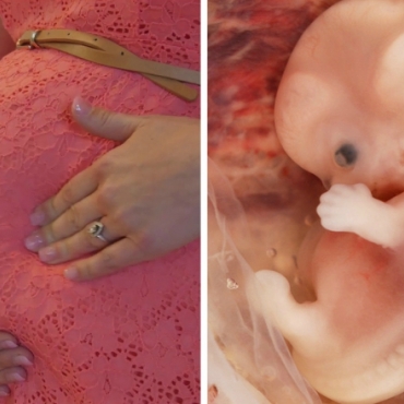 Normal Fetal Movement and Growth