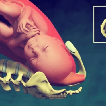 Normal Vaginal Childbirth