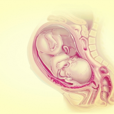 Placenta Accreta: Diagnosis, Risks and Recovery