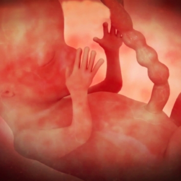 Pregnancy Week 10 - Three Months Pregnant