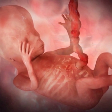 Pregnancy Week 13 - Three Months Pregnant