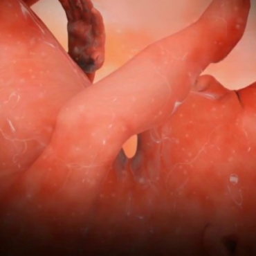 Pregnancy Week 36 - Eight Months Pregnant