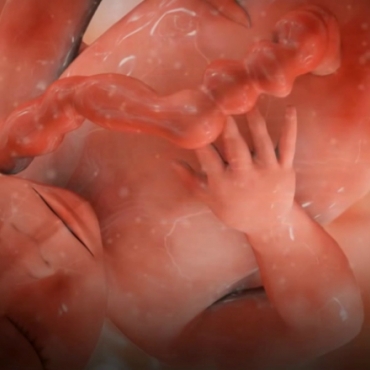 Pregnancy Week 37 - Nine Months Pregnant