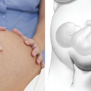 Prenatal Abdominal Examination: Leopold's Maneuvers