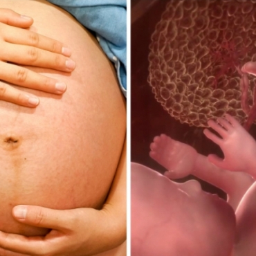 Prevent Rh-Sensitization During Pregnancy