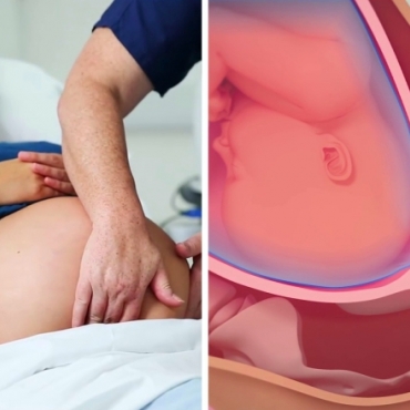 Techniques and Medications for Induction of Labour