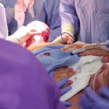 The Gentle Cesarean Birth: A New Option for Moms-to-Be