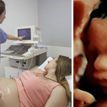 Ultrasound Scans: What You Will Be Able to Find Out About the Baby?