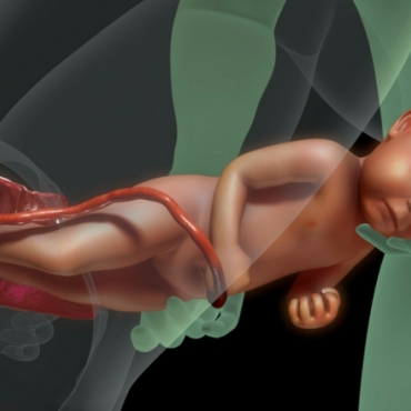 Vaginal Birth: Labour and Normal Delivery