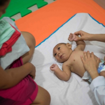 Zika Virus and Microcephaly (Questions and Answers)