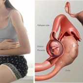 Difference in Ectopic Pregnancy and Normal Pregnancy