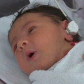 Hearing Screening for Newborn Babies