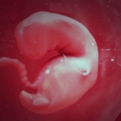 Pregnancy Week 4 - One Months Pregnant